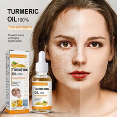 Turmeric Freckle Serum 10ml